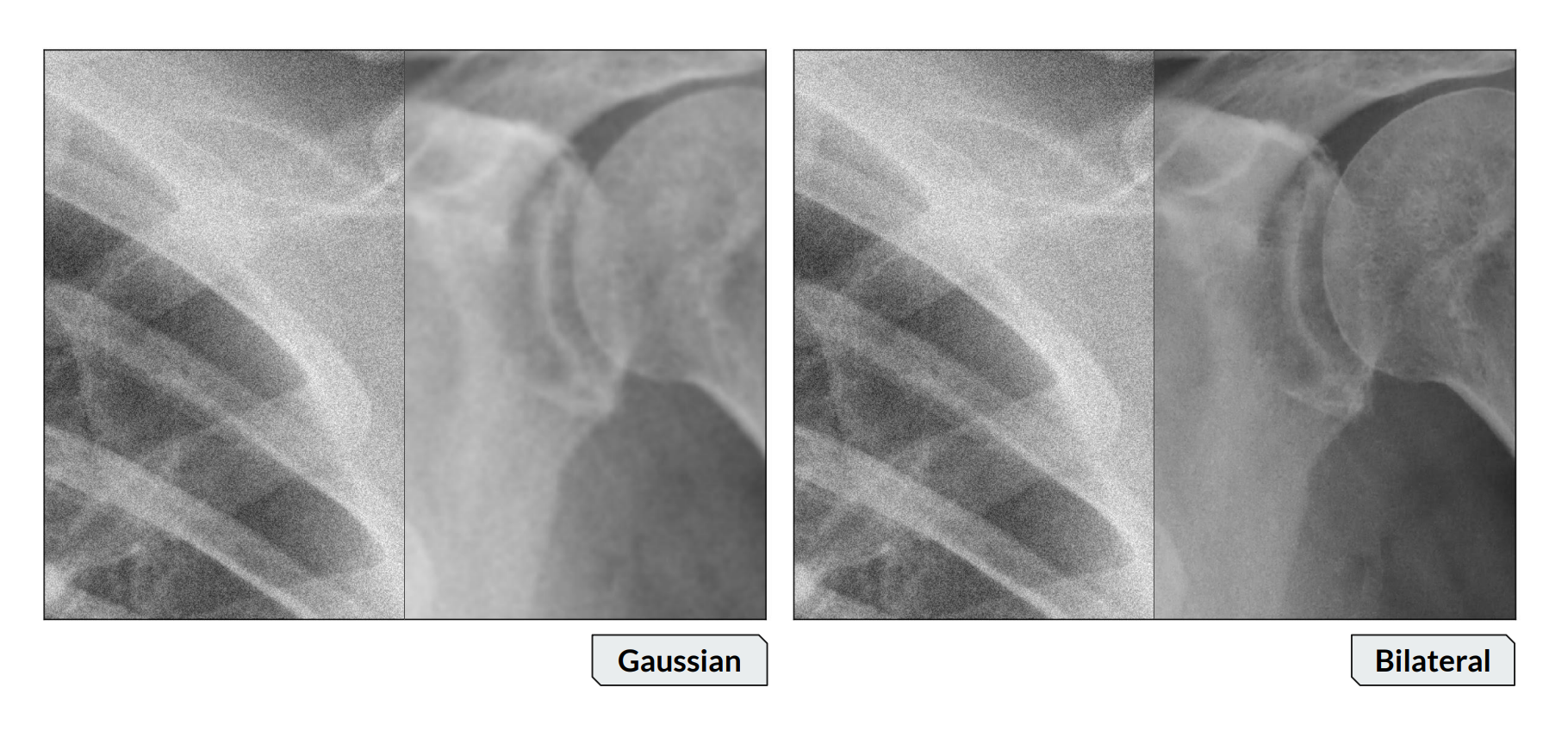 IBEXbilateral